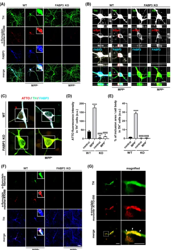 Figure 2. FABP3 is required for the formation of α-Synuclein inclusions in 1-methyl-4- 1-methyl-4-phenylpyridinium (MPP + )-treated dopaminergic neurons