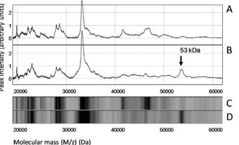 Figure 3. Quantitative assessment of the 53-kDa marker in the clinical samples. Tumor extracts were analyzed using SELDI-TOF on Q10 anion-exchange ProteinChip Arrays, as shown in Figure 2