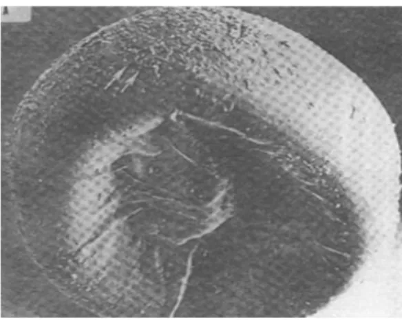 Figure 7: Photographie électronique à balayage d’un cyste déshydraté d’Artémia     La coquille du cyste ou le chorion se compose de trois couches (figure 8): 