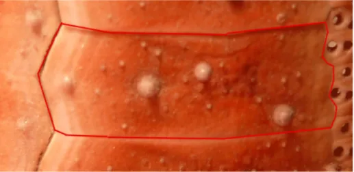 Figure 15 : Echinus melo en encadré une plaque inter ambulacraire, bordée à droite de trois petites  plaques ambulacraires 