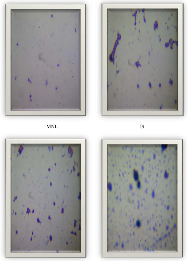 Figure n° 04: observation microscopique des souches I7, I1, MNL, I9 grossissement (× 100)  après une coloration de Gram