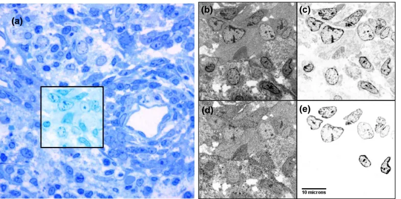 Figure 2  Iodine location at the subcellular level determined by Nano-SIMS analysis. The F98 glioma-bearing rat received an intratumoral injection of IUdR during 6 days  by the means of osmotic pump