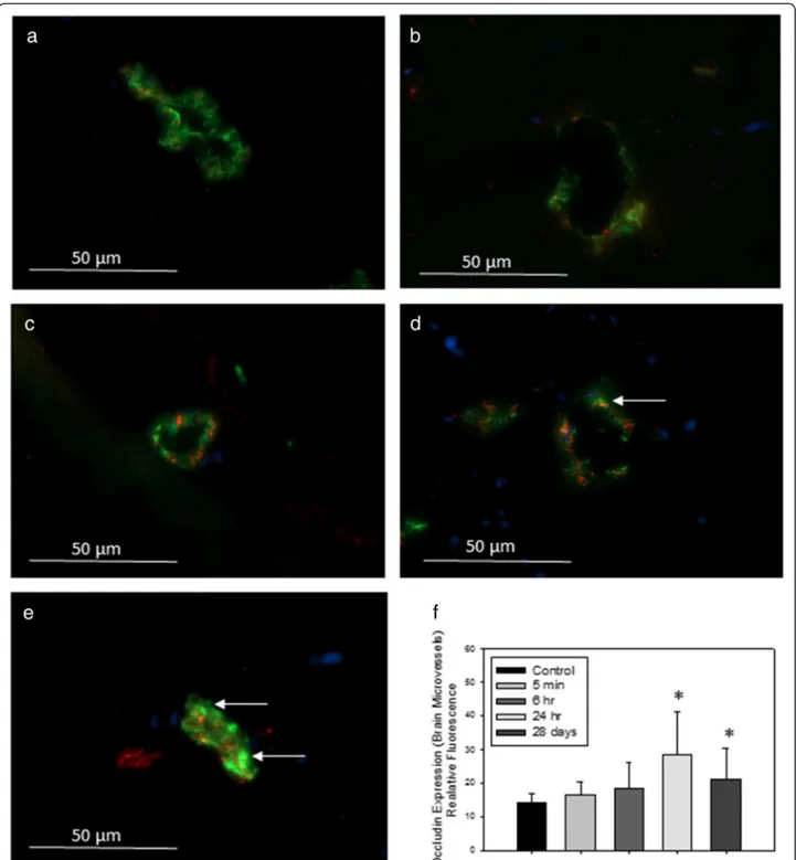 Fig. 6 2Representative images of immunofluorescence expression of tight junction protein occludin (red) and endothelial cell marker vonWillenbrand factor (vWF, green) in the cerebral microvasculature of (a) control rats, or tissues collected from rats trea