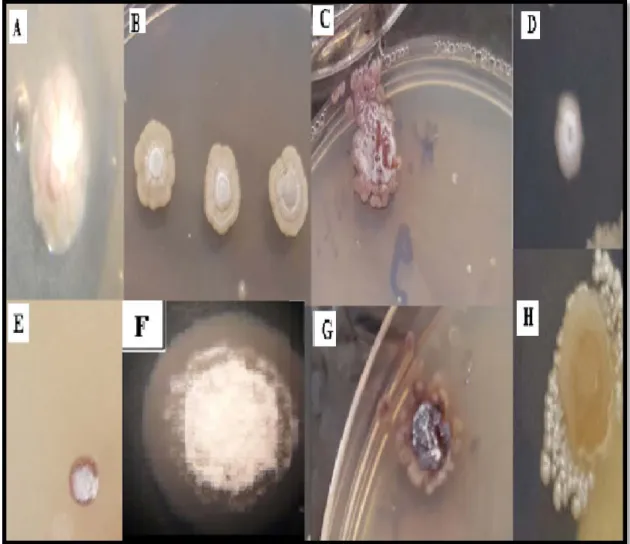 Figure 9: Observations macroscopiques des colonies d’actinobactéries à l’aide d’une loupe  binoculaire 4x10