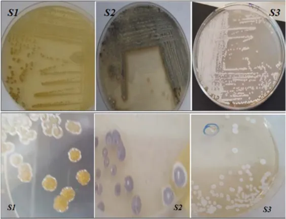 Fig. 7: Observations macroscopiques des colonies d’actinobactéries à l’aide d’une l’œil nu