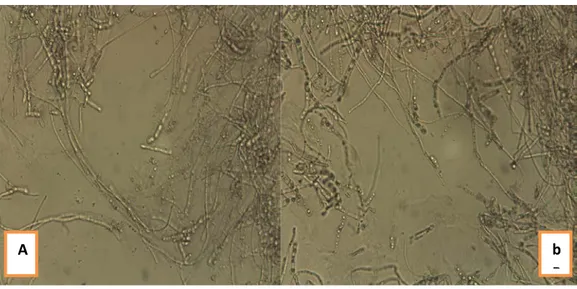 Figure N°10 : Aspect Microscopique des Isolats du Fusarium sp  A : Aspect microscopique du mycélium Fusarium sp1 