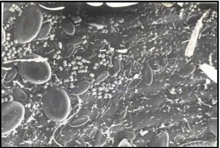 Fig6 :  Biofilm  présent  sur  des  feuilles  de  posidonies  où  on  peut  reconnaître  divers  types  de  bactéries  et  de  diatomées (Dauby &amp; Poulicek, 1995)