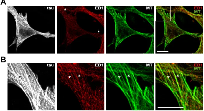 Figure S2. EB1 relocates along tau-induced microtubule bundles in fibroblasts upon  high  tau  expression  levels