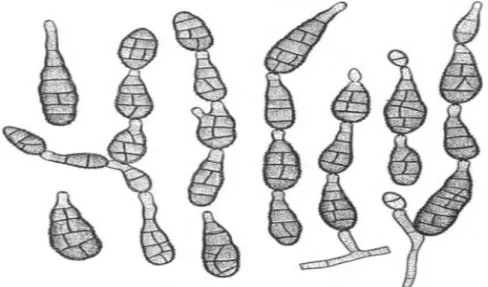 Figure 8 : Conidies d’Alarnaria alternata (Ellis, 1971) 