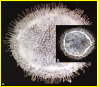 Figure 12: Présentation des gonades de Xyloplax, Infraclasse des concentricycloidea,  A- facedorsal