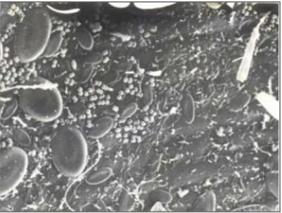 Fig. 10 : Biofilm présent sur des feuilles de posidonies où on peut reconnaître   divers types de bactéries et de diatomées (Dauby et Poulicek, 1995)