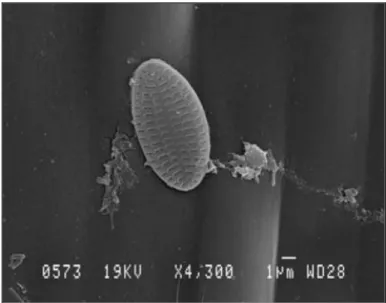 Fig. 12 : Diatomée du genre Cocconeis sur une feuille de Posidonia oceanica prise  au microscope à transmission électronique (Gr : x4300) (d’après Pête, 2005)