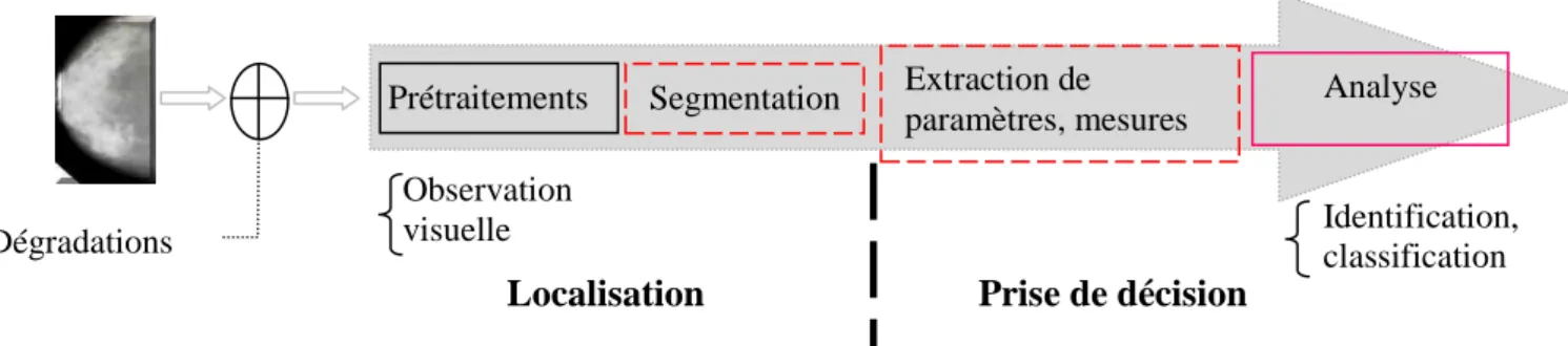 Fig. I.9 – Schéma général d’une chaîne de détection de microcalcifications en image mammographie