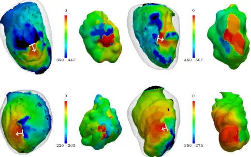 Fig. 5. Comparison of predicted (left) activation maps (in ms) to \ground truth&#34; data (right) obtained from VT recording during RF catheter ablation in 4 dierent  pa-tients