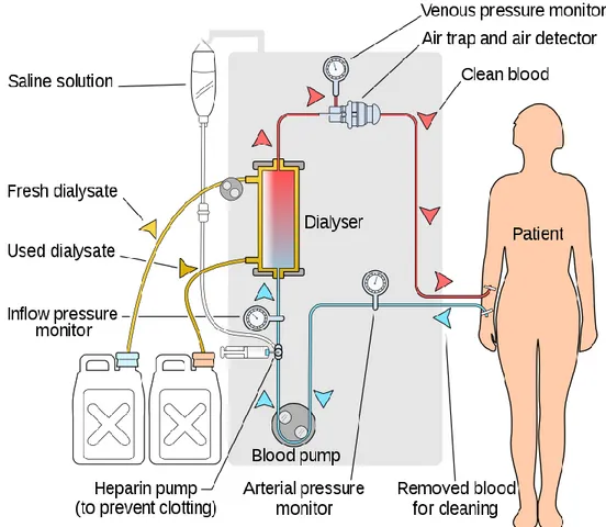 Figure 2 : Schématisation du processus d'hémodialyse (Penot, 2019). 