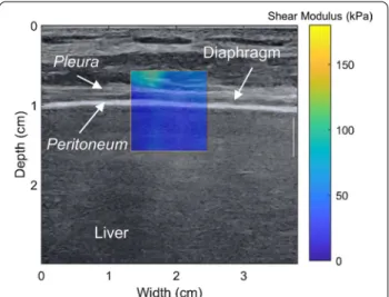 Fig. 1. Local muscle shear modulus (i.e. stiffness) meas- meas-ured using SWE has been shown to provide reliable  esti-mates of passive and active muscle force in locomotor  muscles [21,  22]