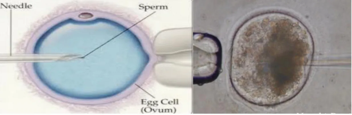 Figure 9 : Technique d’ICSI (photo :  Denis NECCI, 2017 ) 