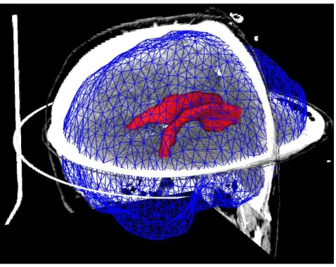 Figure 2: Finite element mesh used for the simulation overlaid on cross sections of the CT scan of the patient (only the cortex and ventricles surfaces are shown).