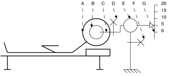 Figure 3: Scheme of the external derivation after the shunt insertion. (A) Head of the patient