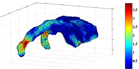 Figure 5: Distribution of the displacement error on the ventricle surface mesh (mm).