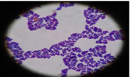 Figure 3: S.aureus vu au microscope après coloration de Gram (IJVS, 2014). 