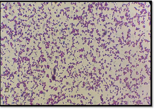 Figure 02. Staphylococcus aureus observé au microscope électronique à transmission (×100)  1.2 Caractères culturaux  