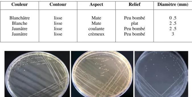 Tableau  5  :  Principales  caractéristiques  morphologiques  des  colonies  de  bactéries  lactiques isolées