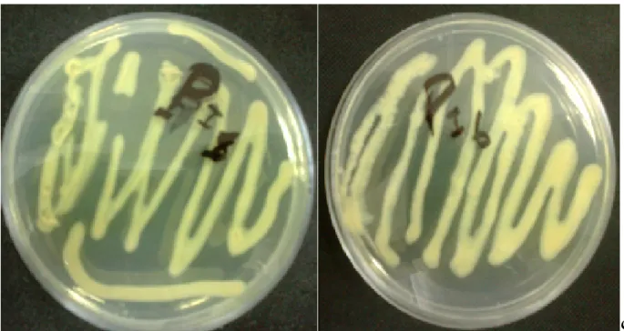 Figure  7    : Quelques isolas incubées sur KingB avec production de pyoverdine à couleur  jaune  verdâtre