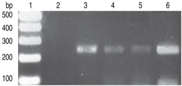 Figure 9: Analyse  PCR  de colonies de Lactobacillus acidophilus de type L10 (Su, et al., 2017)