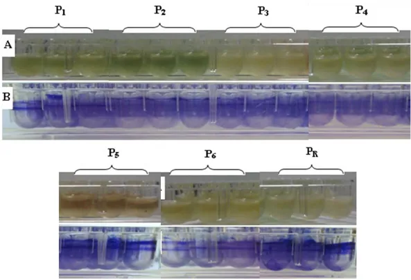 Figure 19 : La différence remarquée entre les souches testées de P. aeruginosa. 