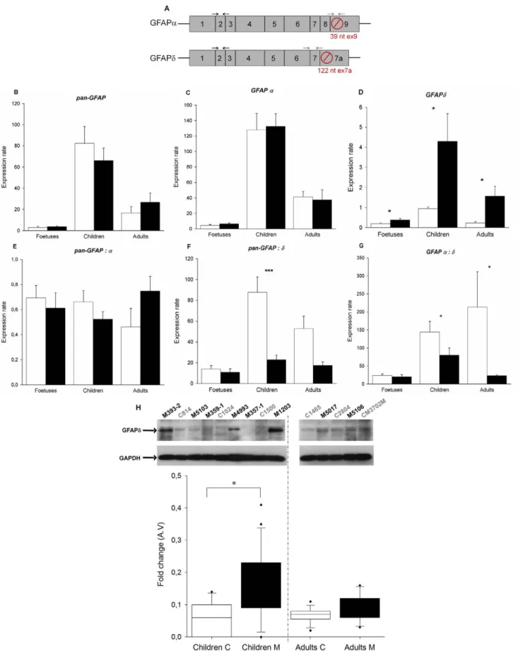 Figure 3. Study of the splice GFAP in eIF2B-mutated patients brains. A. Transcripts of human GFAP splice variants