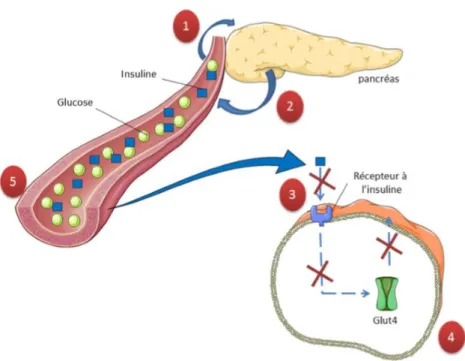 Figure 3 : Mécanisme de dysfonctionnement de l'homéostasie du glucose dans le diabète  de type 2 adapté de (Kharroubi et Darwish, 2015)