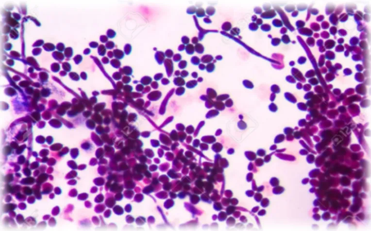 Figure 26 :  Morphologie de staphylococcus aureus                                                                    