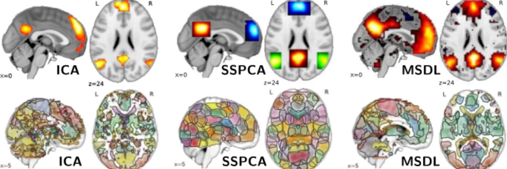 Fig. 1. Output of different decomposition models: from left to right, ICA, SSPCA and MSDL