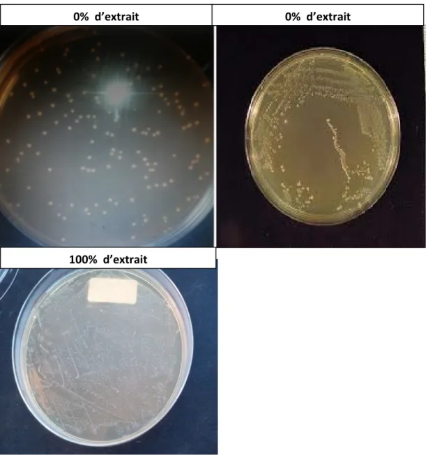 Figure 9 : Effet des différentes dilutions d’extraits à l’éthanol de Thymus vulgaris sur la                                            croissance de Streptococcus thermophilus 