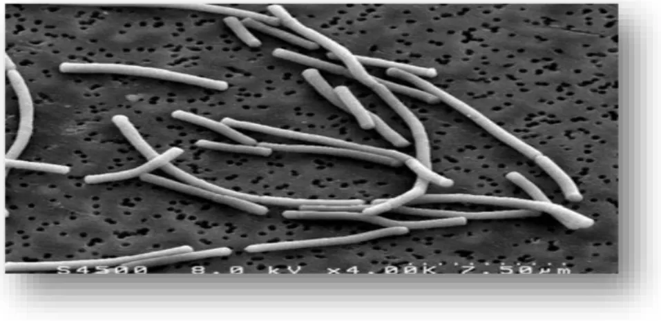 Figure 1.Lactobacilus bulgaricus observé au microscope électronique à transmission  (×10000) 