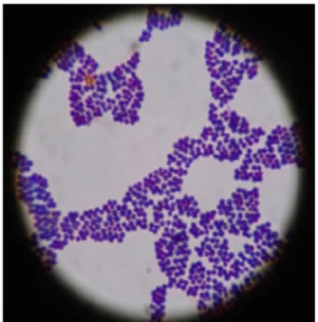 Figure 2. S. aureus vu au micro-  scope après coloration de Gram  (IJVS, 2014).  
