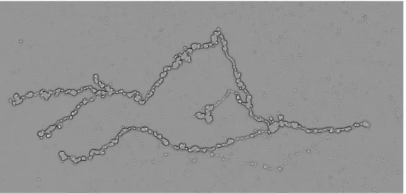 Figure 4.2: Result obtained by FeatureJ on one of our axonal images.