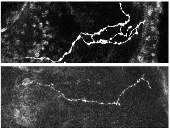Figure 5.1: Normal (top) and mutant (bottom) axons (maximum intensity projec- projec-tions).