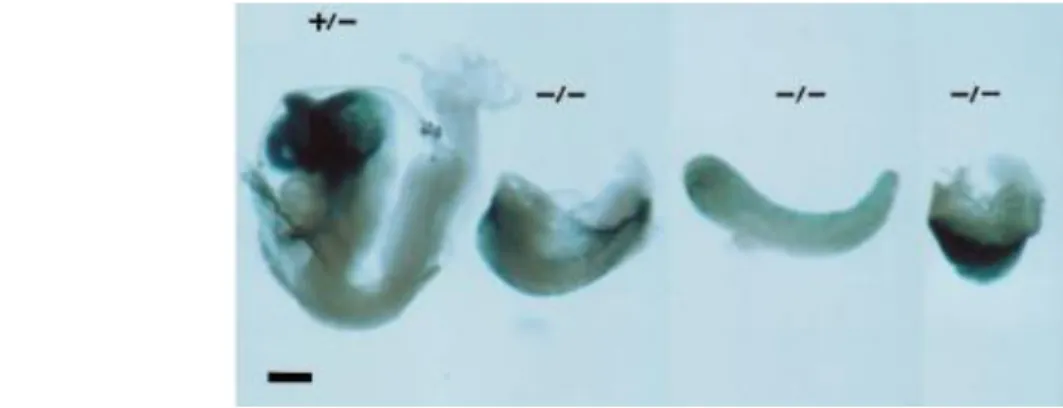 Figure 3 : Défauts de développement chez les embryons de souris mutants Otx2. 
