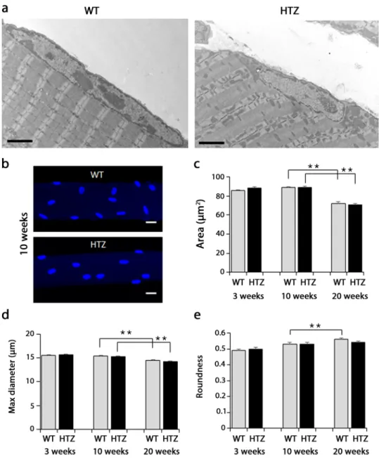 Figure 1.  Ultrastructure and morphometric analysis of myonuclei in TA muscle from WT and HTZ KI-Dnm2  mice