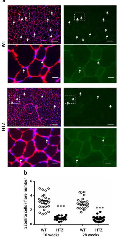 Figure 4.  Number of satellite cells in TA muscles from KI-Dnm2 mice. (a) Representative images of  immunostaining in TA muscle at 28 weeks of age in WT and HTZ mice