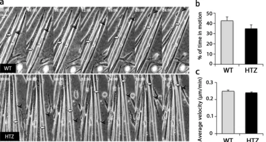 Figure 6.  Nuclear movement in myotubes from WT and HTZ KI-Dnm2 mice. (a) Pictures showing frames of  different movies at 0, 4, 8, 12, 16, 20, and 24 hours