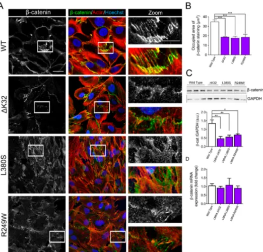 Figure 3. β-catenin in WT and mutant muscle cell precursors. (A). Confocal immunofluorescence images of F-actin (phalloidin, red) and β-catenin (white or green) in wild-type and LMNA mutant (∆K32, L380S and R249W) mutant myogenic cell precursors