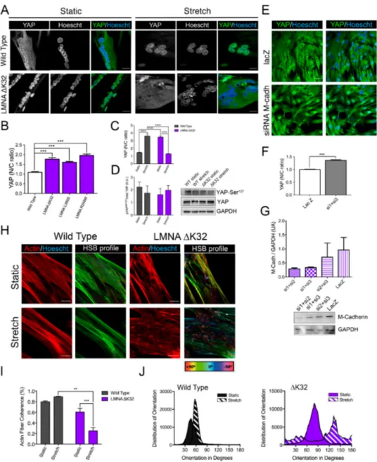 Figure 4. Adaptability of WT and LMNA ∆K32 myotubes to cyclic stretch (A) Yes-associated protein (YAP, in green) in WT and LMNA ∆K32 mutant myotubes (72 h differentiation) in static and after stretch