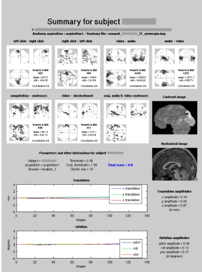 Figure 2: This summary sheet generated for each of the subjects helps assess the quality of the fMRI acquisition