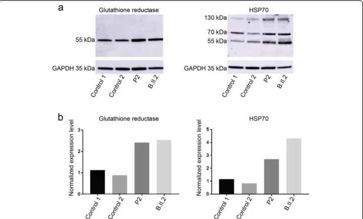 Fig. 7 Increased oxidative stress markers. a Western blot and b quantification on muscle extracts from two PYROXD1 patients revealed increased protein levels of HSP70 monomers (70 kDa) and dimers (140 kDa) and glutathione reductase compared with age-matche