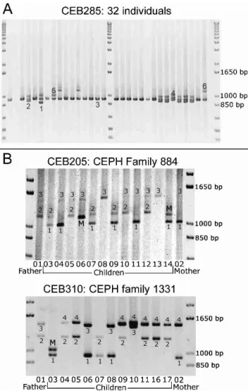 Figure 2 (A) Ethidium bromide–stained agarose gel showing PCR products for minisatellite CEB285.Six different alleles are scored among 32 individuals (in some cases, three bands are seen for one individual [the upper one is a PCR artifact as shown by segre