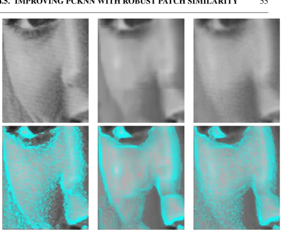 Figure 4.10: A close-up on the image Elaine. From left to right: Original, BM3D, and PCkNN