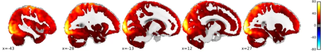 Figure 3: Group-level F-map, at a threshold of p < .05 , Bonferroni-corrected, representing the total area of the brain signicantly covered by all tasks featuring the rst release of the IBC dataset (FFX across tasks and subjects)